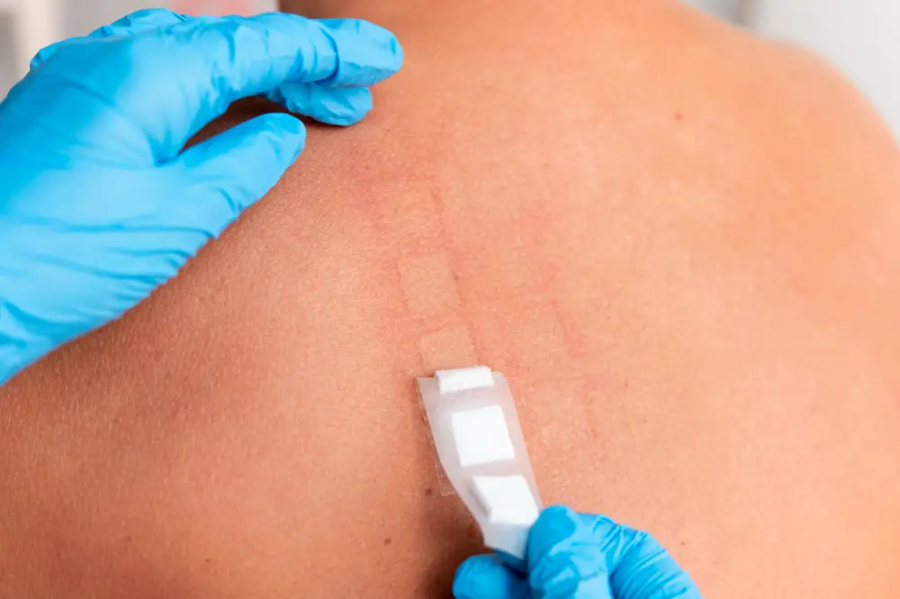 Skin Patch Test